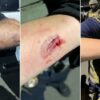 Biting Federal Agents Is Not Protest and This New Jersey Man Just Found Out Why