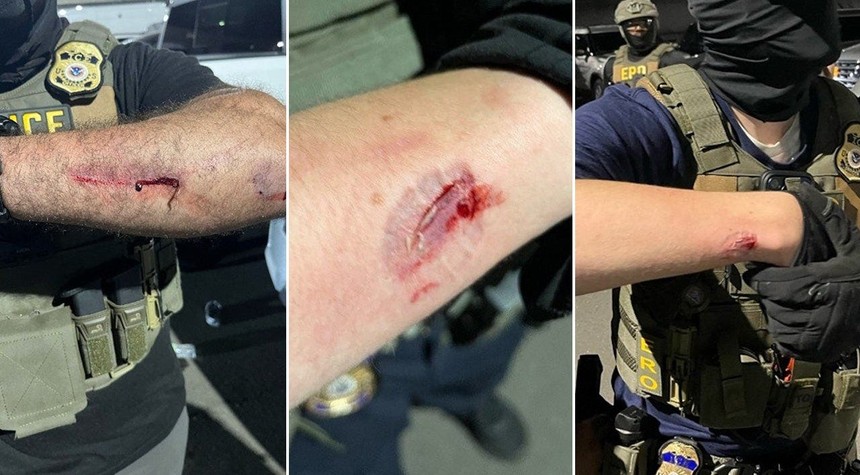 Biting Federal Agents Is Not Protest and This New Jersey Man Just Found Out Why