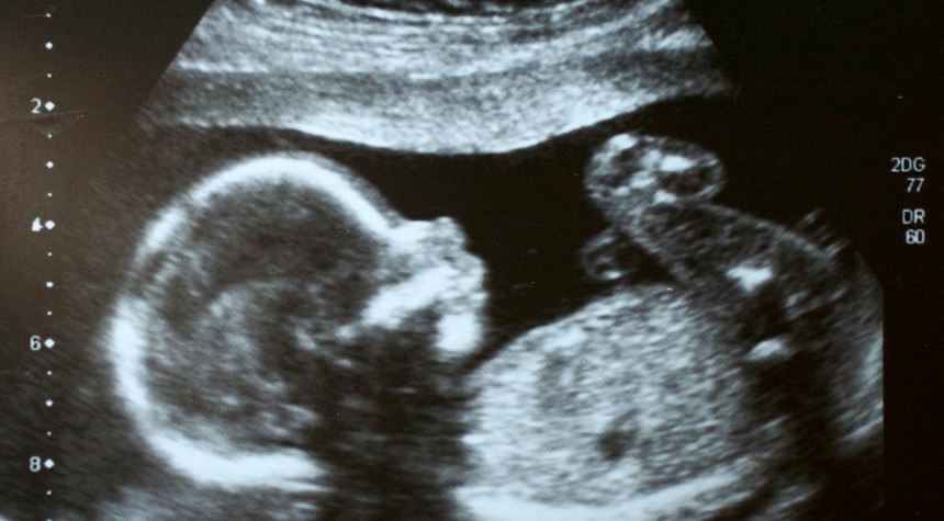 Fifty Years of Protecting Taxpayers From Funding Abortions Under Attack Again