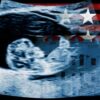 New Federal Policy Treats Unborn Children as Foster Care Candidates